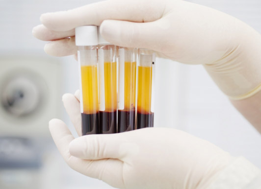 Plasma Stockpiling Critical Plasma Stockpiling Critical