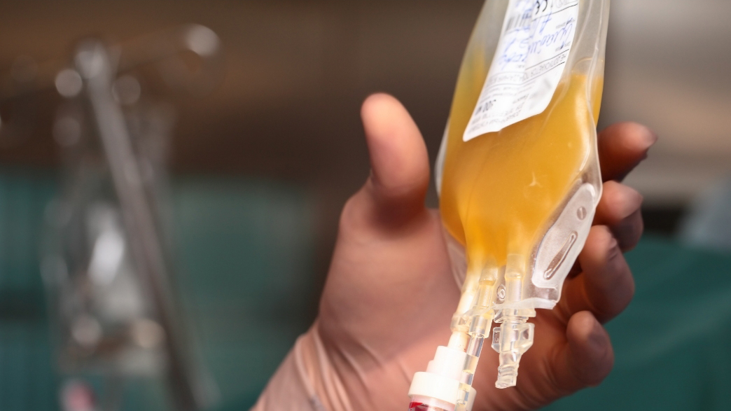 Bag of plasma supervised by medical professional in a hospital setting.